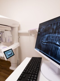 Ansicht eines Computers mit Röntgenbild neben einem Röntgengerät